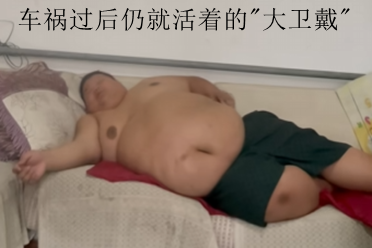 吃播狠人良子大胃袋，车祸过后仍活着的传奇“大卫戴”
